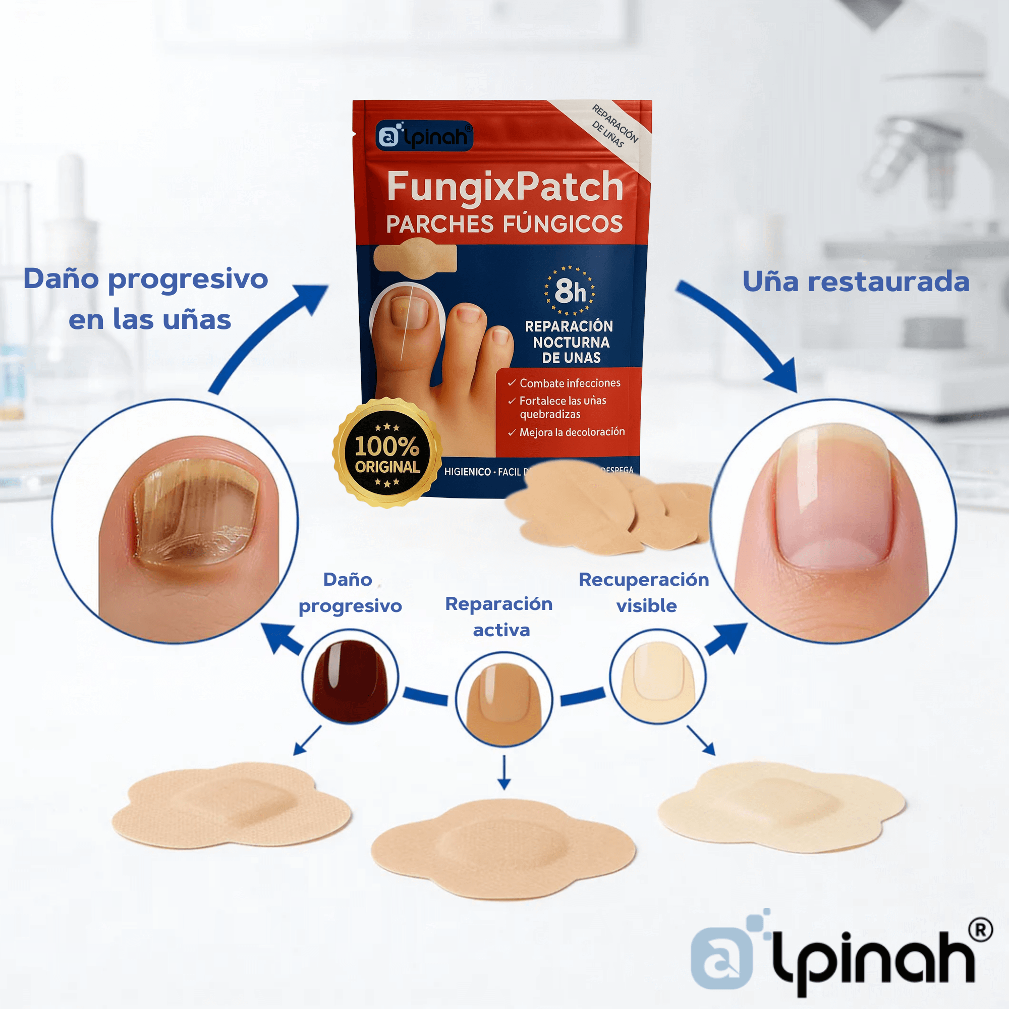 FungixPatch™ Tratamiento antifúngico avanzado