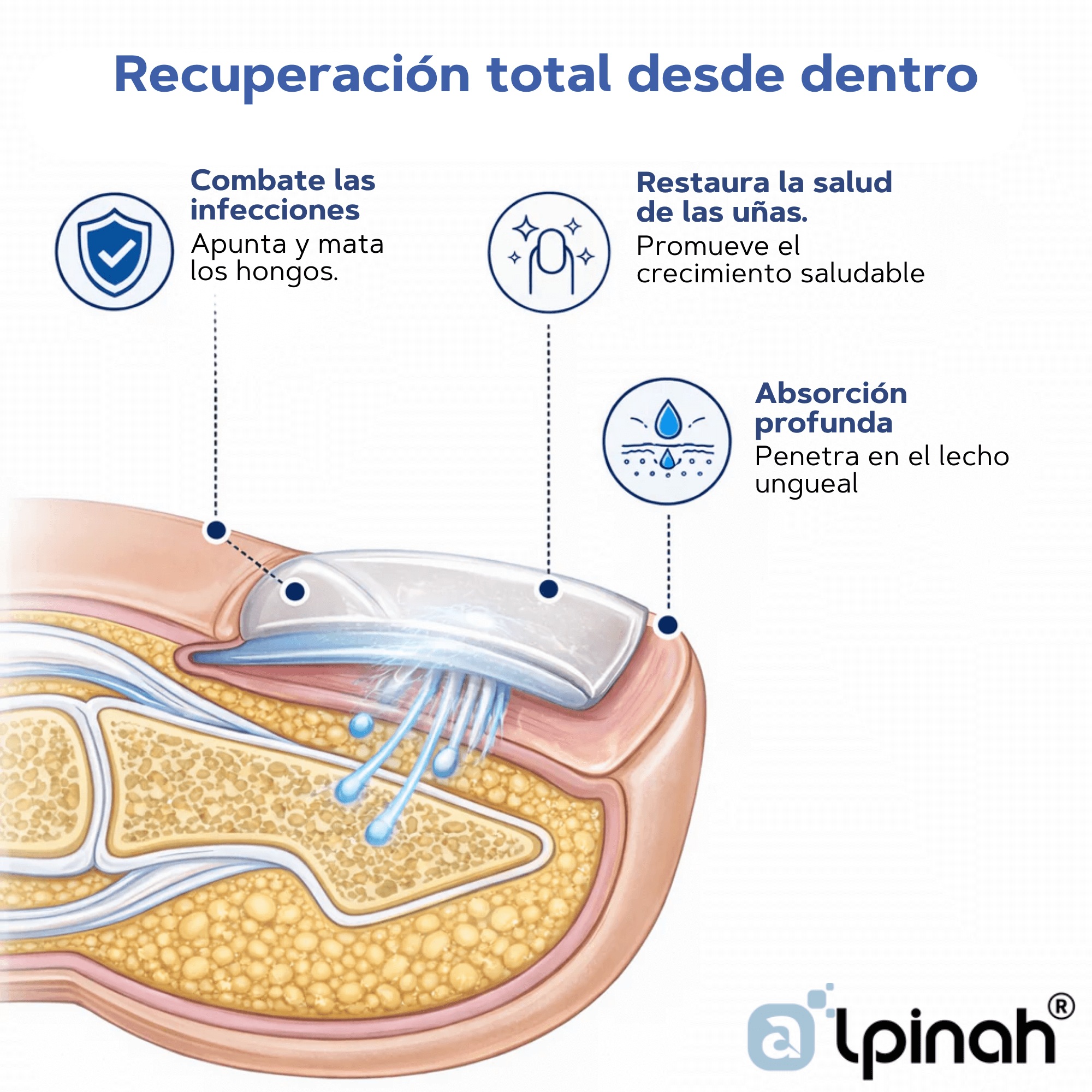 FungixPatch™ Tratamiento antifúngico avanzado